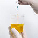Urine Tests
