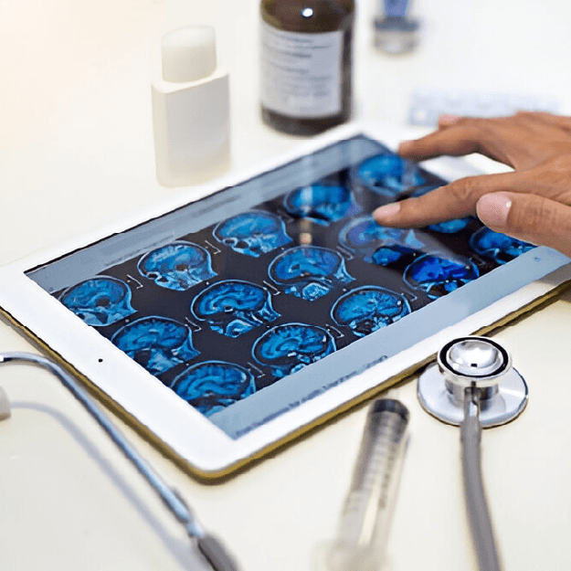 Migraine Diagnosis & Evaluation
